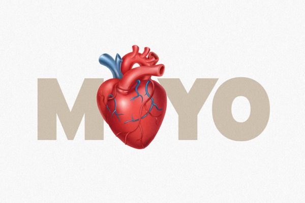 Diamond Platnumz – Moyo Mp3 Download